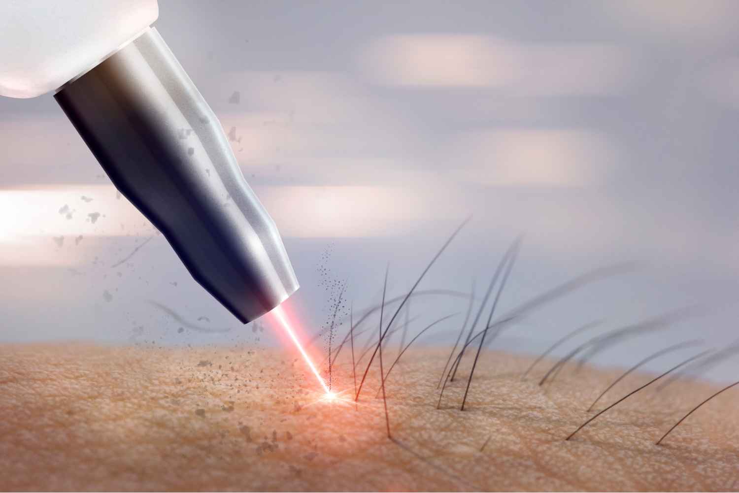 All You Ever Wanted to Know About Laser Hair Removal Nyc
