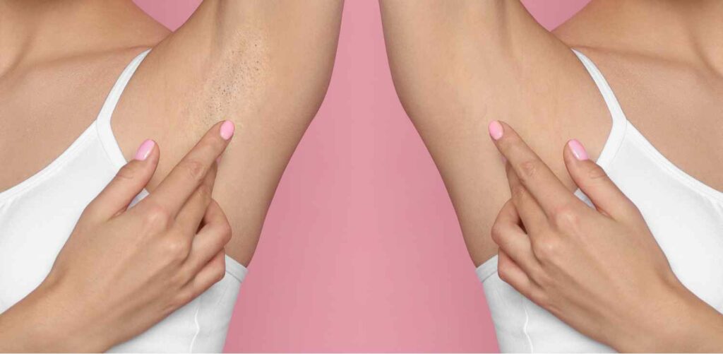 To Shave, To Wax, Or To Laser? | Manhattan Laser Spa