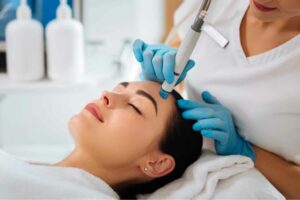 Dark Spot Treatment in Hollywood, FL 3 Hydrafacial manhattan laser spa