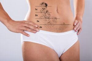 Laser tattoo removal manhattan laser spa