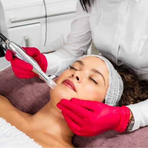 Woman receiving her 3 Sessions of Microneedling Treatment | Manhattan Laser Spa in NYC