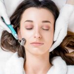 PRP + Microneedling – 1 session