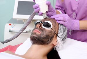 Chemical Peels in Hallandale Beach, FL 3 carbon laser facial manhattan laser spa 1