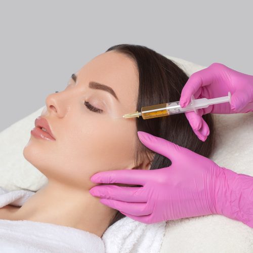 PRP Therapy For Hair Loss