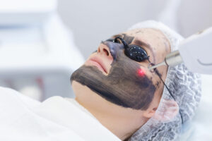 carbon laser facial manhattan laser spa Midtown Newyork