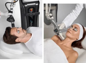 Acne Scar Treatment in Hollywood, FL 1 two pictures of man and woman receiving coolpeel treatment on hand and forehead