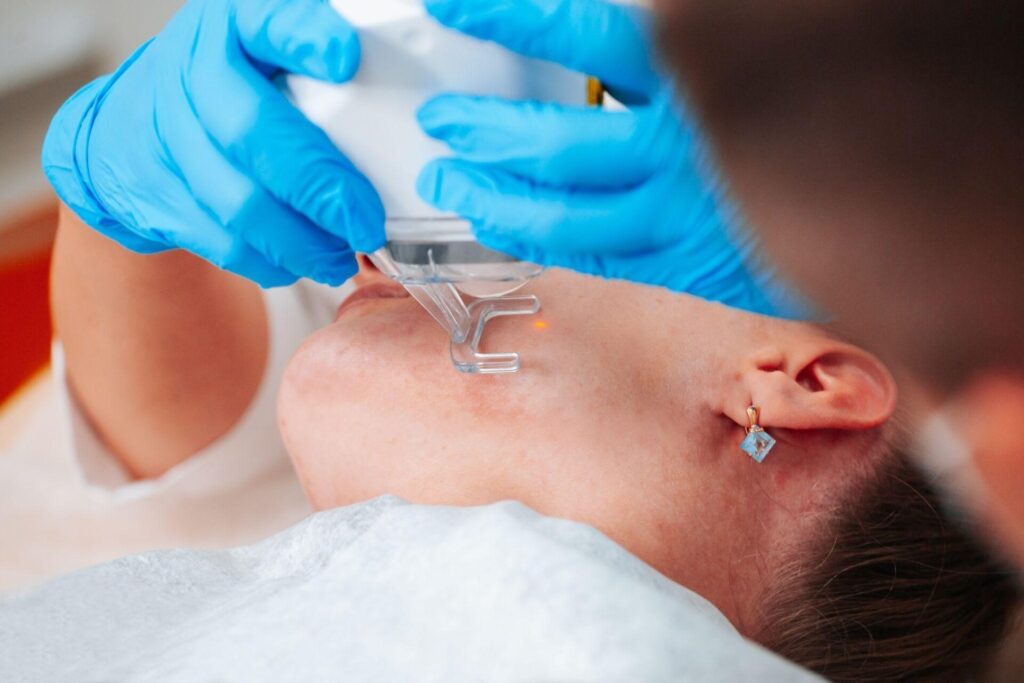 laser skin resurfacing guide