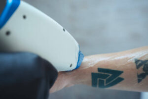 gettyimages 1661708756 612x612 1