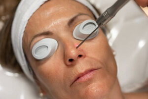 istockphoto 2233795728 612x612 1