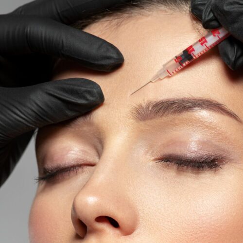Botox ( 1 Unit ) - Valentines Day PROMO